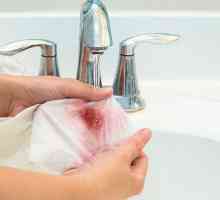 Как да се измие прясна или сушена кръв от дрехите?