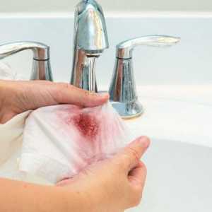 Как да се измие прясна или сушена кръв от дрехите?